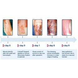 CUTICELL EPIGRAFT